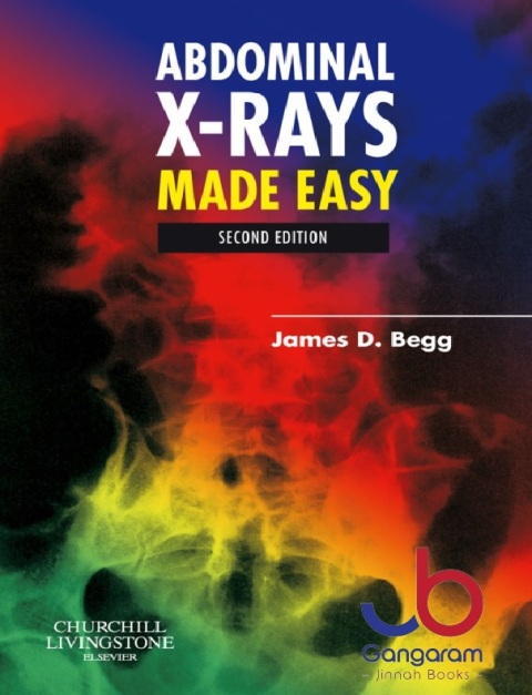 Abdominal X-Rays Made Easy 2nd Edition