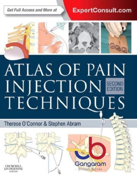 Atlas of Pain Injection Techniques 2nd Edition