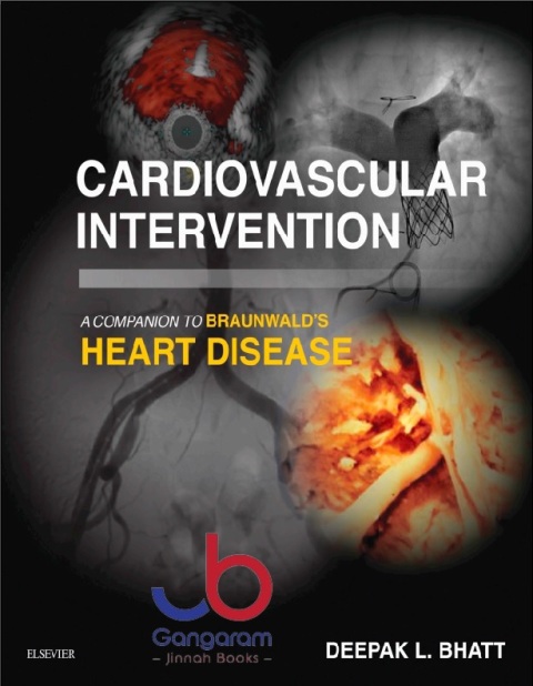 Cardiovascular Intervention A Companion to Braunwald’s Heart Disease 1st Edition