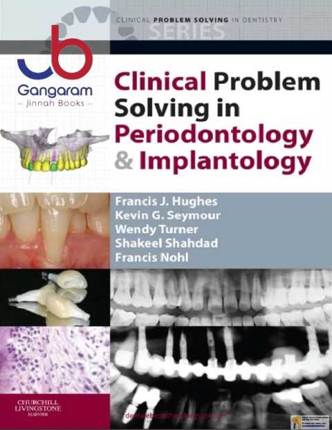 Clinical Problem Solving in Periodontology and Implantology.