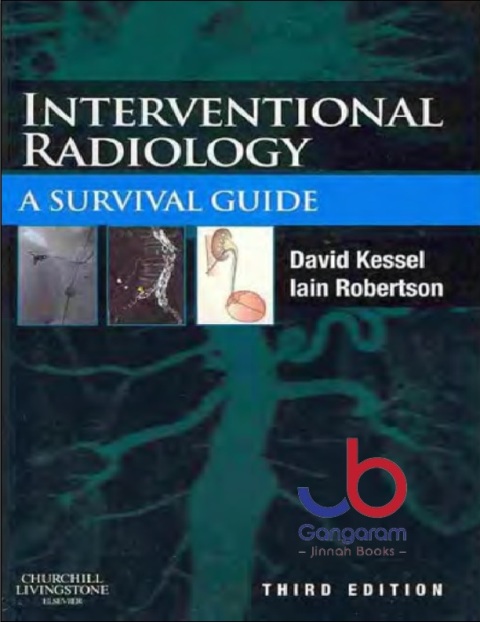 Interventional Radiology A Survival Guide 3rd Edition