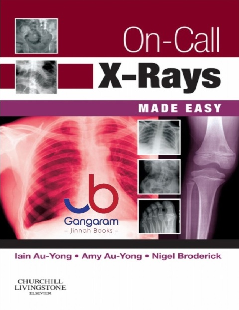 On-Call X-Rays Made Easy 1st Edition