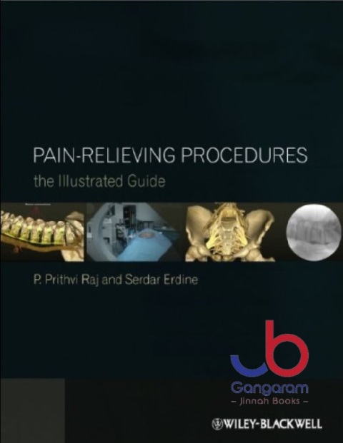 Pain-Relieving Procedures The Illustrated Guide 1st Edition