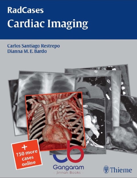 Radcases Cardiac Imaging (Radcases Plus Q&A) 1st Edition
