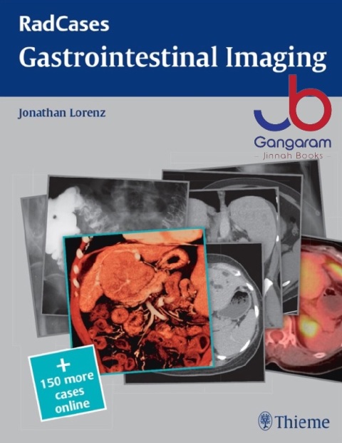 Radcases Gastrointestinal Imaging (Radcases Plus Q&A) 1st Edition