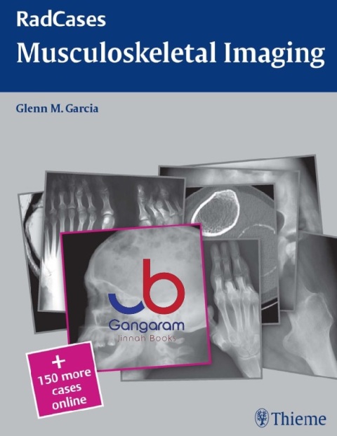 Radcases Musculoskeletal Radiology (Radcases Plus Q&A) 1st Edition