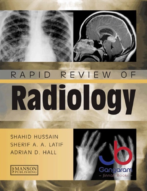 Rapid Review of Radiology (Medical Rapid Review Series) 1st Edition