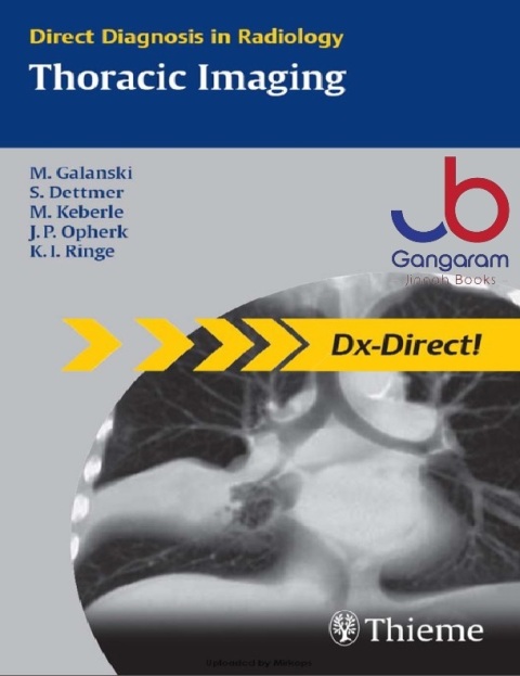 Thoracic Imaging (Direct Diagnosis in Radiology) 1st Edition