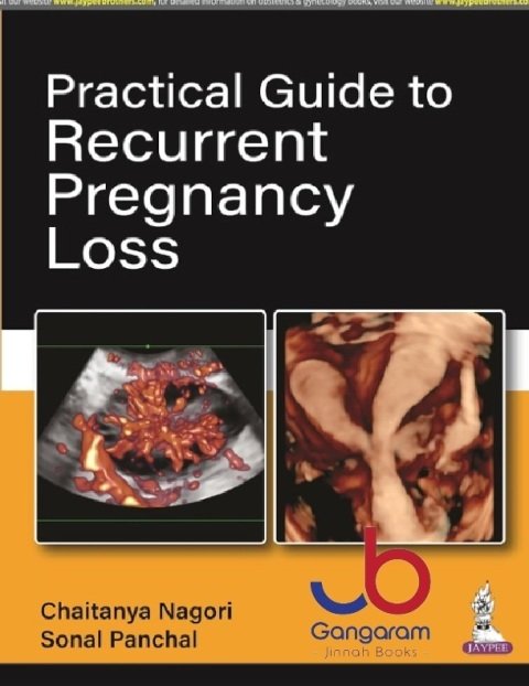 Practical Guide to Recurrent Pregnancy Loss