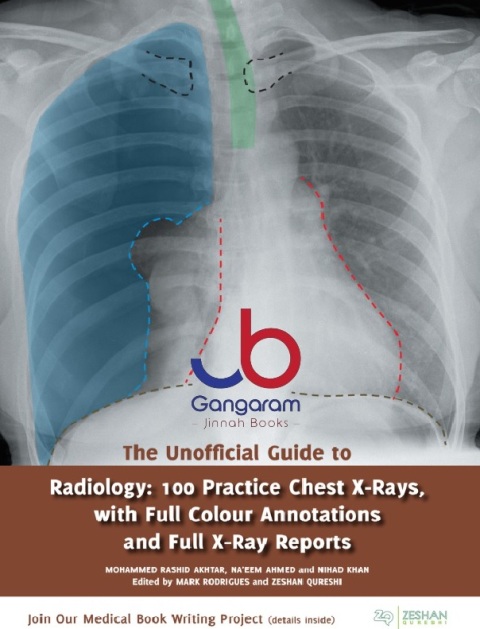 The Unofficial Guide to Radiology 100 Practice Chest X Rays with Full Colour Annotations and Full X Ray Reports