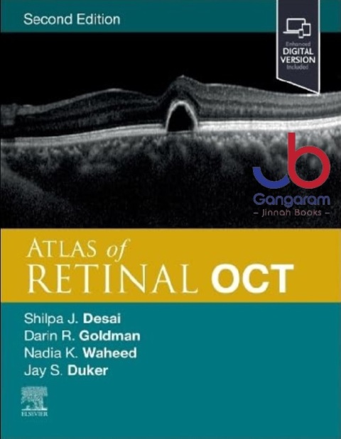 Atlas of Retinal OCT Optical Coherence Tomography 2nd Edition