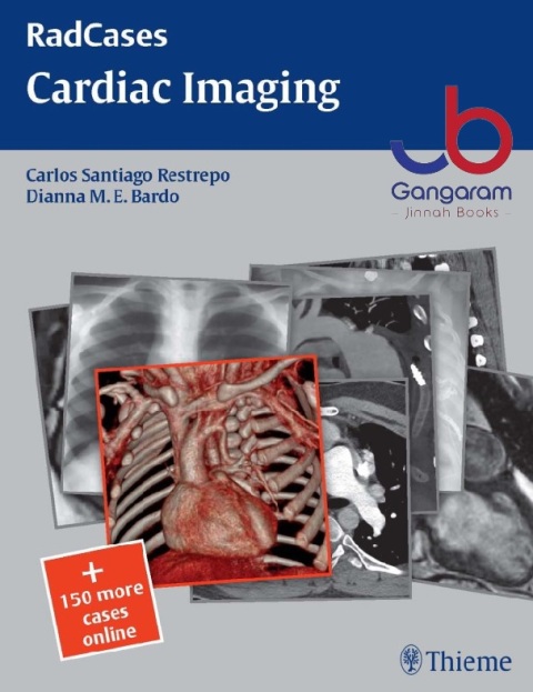 RadCases Cardiac Imaging, 1st edition (Radcases Plus Q&A) 1st Edition