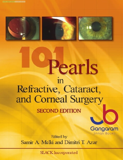 101 Pearls in Refractive, Cataract, and Corneal Surgery 2nd Edition