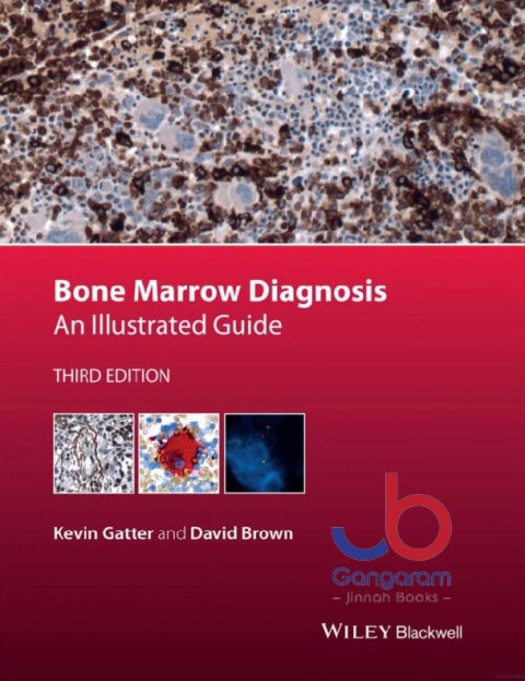 Bone Marrow Diagnosis An Illustrated Guide 3rd Edition