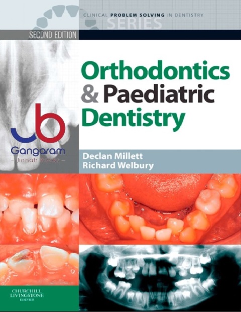 Clinical Problem Solving in Orthodontics and Paediatric Dentistry, 2e (Clinical Problem Solving in Dentistry)