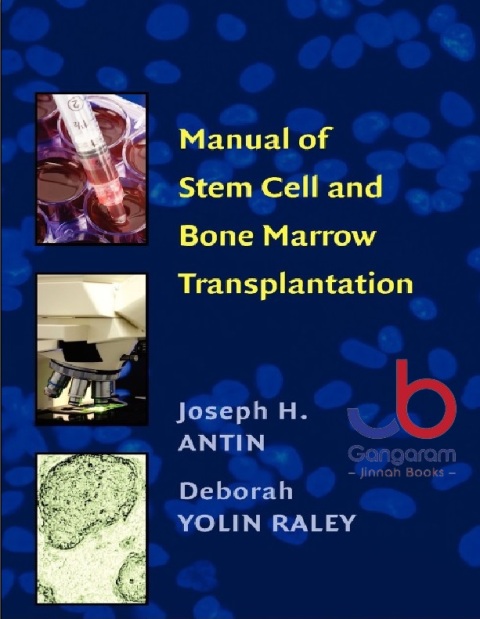 Manual of Stem Cell and Bone Marrow Transplantation 1st Edition