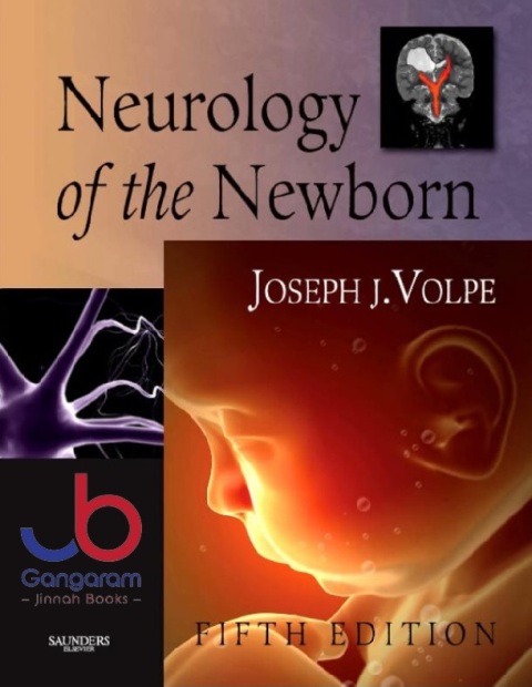 Neurology of the Newborn,(Volpe, Neurology of the Newborn) 5th Edition