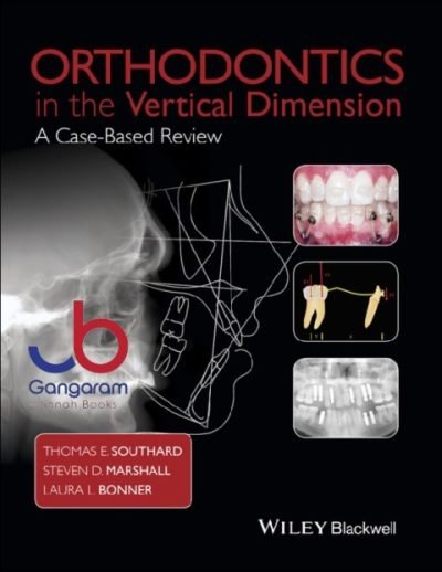 Orthodontics in the Vertical Dimension: A Case-Based Review 1st
