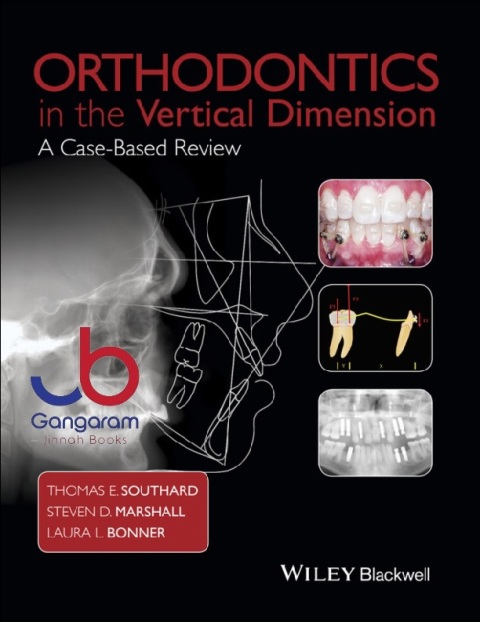Orthodontics in the Vertical Dimension A Case-Based Review 1st Edition