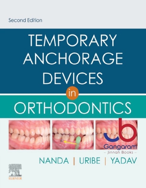 Temporary Anchorage Devices in Orthodontics 2nd Edition