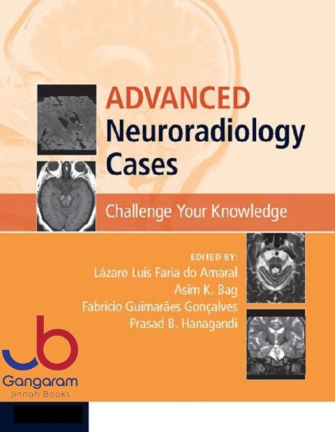 Advanced Neuroradiology Cases Challenge Your Knowledge 1st Edition