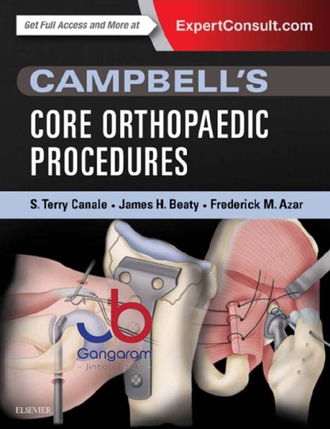 Campbell's Core Orthopaedic Procedures 1st Edition