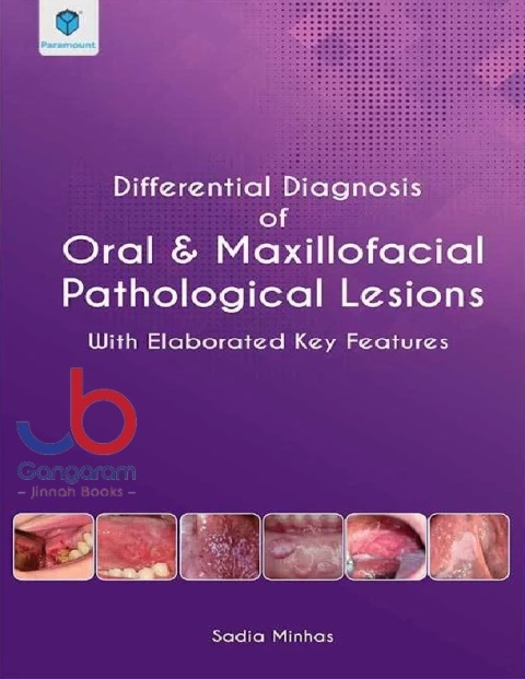DIFFERENTIAL DIAGNOSIS ORAL & MAXILLOFACIAL PATHOLOGICAL LESIONS WITH ELABORAATED KEY FEATURES