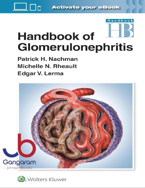 Handbook of Glomerulonephritis First Edition