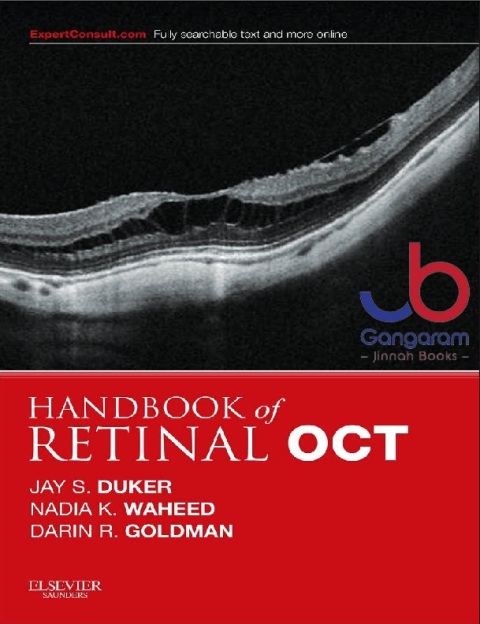 Handbook of Retinal OCT Optical Coherence Tomography