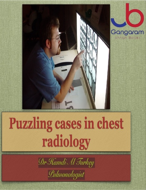 Puzzling cases in chest radiology.
