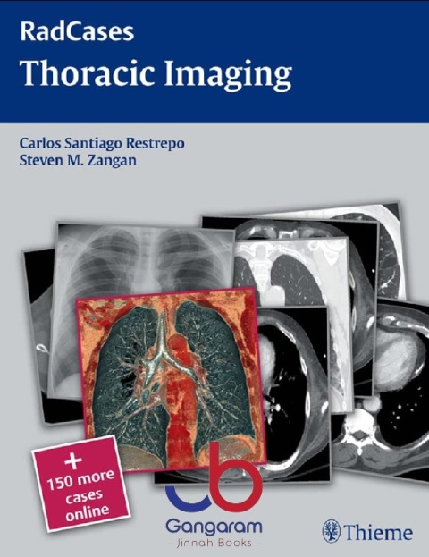 Radcases Thoracic Imaging (Radcases Plus Q&A) 1st Edition