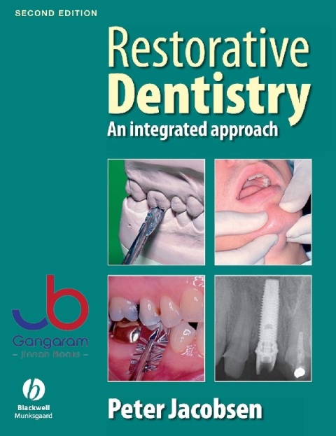 Restorative Dentistry An Integrated Approach 2nd Edition