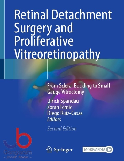 Retinal Detachment Surgery and Proliferative Vitreoretinopathy From Scleral Buckling to Small Gauge Vitrectomy 2nd ed. 2022 Edition
