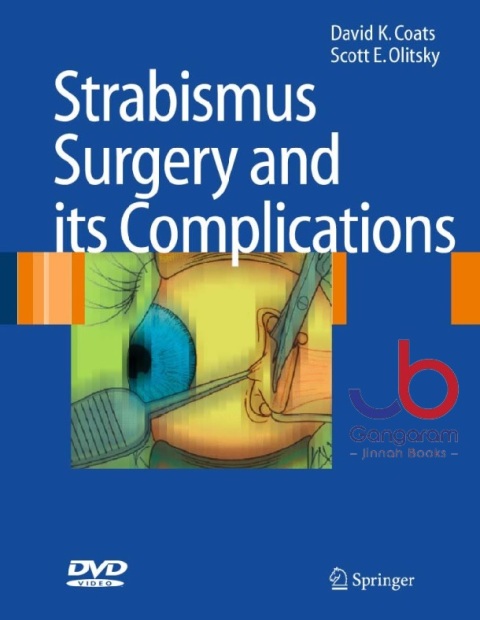 Strabismus Surgery and its Complications 2007th Edition