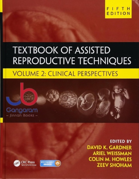 Textbook of Assisted Reproductive Techniques Volume 2 Clinical Perspectives 5th Edition