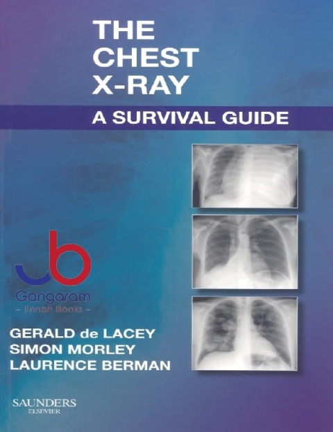 The Chest X-Ray A Survival Guide 1st Edition