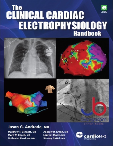 The Clinical Cardiac Electrophysiology Handbook 1st Edition