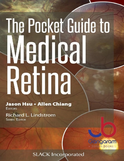 The Pocket Guide to Medical Retina (Pocket Guides) 1st Edition