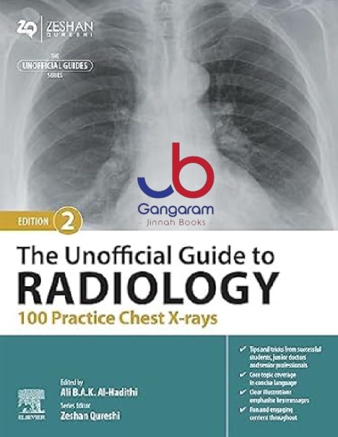 The Unofficial Guide to Radiology 100 Practice Chest X-rays