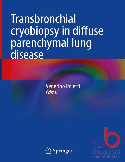 Transbronchial cryobiopsy in diffuse parenchymal lung disease