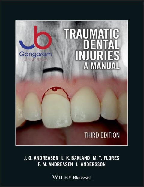 Traumatic Dental Injuries A Manual 3rd Edition