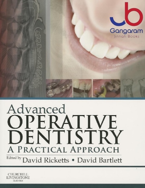 Advanced Operative Dentistry A Practical Approach
