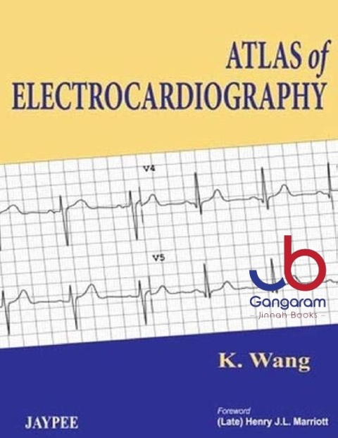 Atlas of Electrocardiography 1st Edition