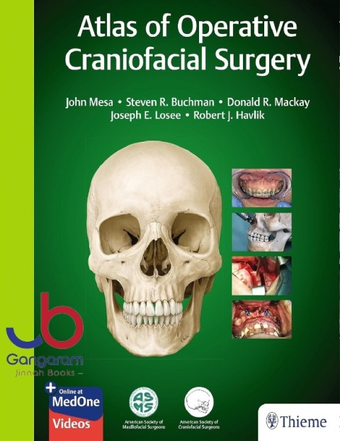 Atlas of Operative Craniofacial Surgery 1st Edition