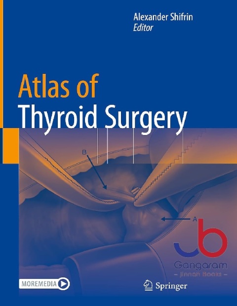 Atlas of Thyroid Surgery 1st ed. 2022 Edition