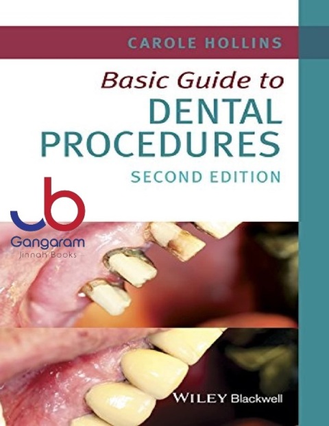 Basic Guide to Dental Procedures (Basic Guide Dentistry Series)