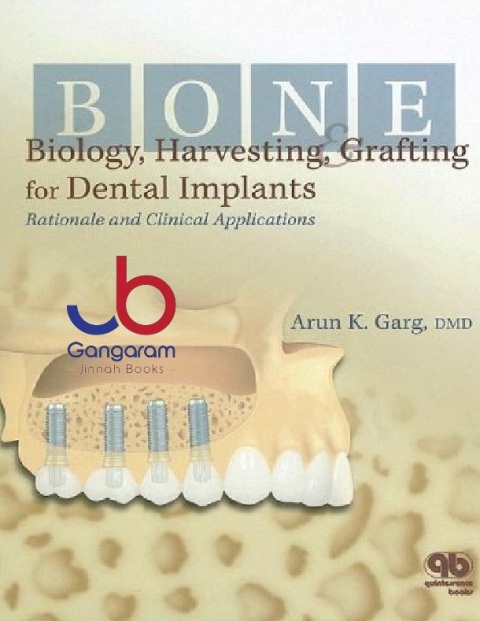 Bone Biology, Harvesting, & Grafting For Dental Implants Rationale and Clinical Applications by Arun K. Garg