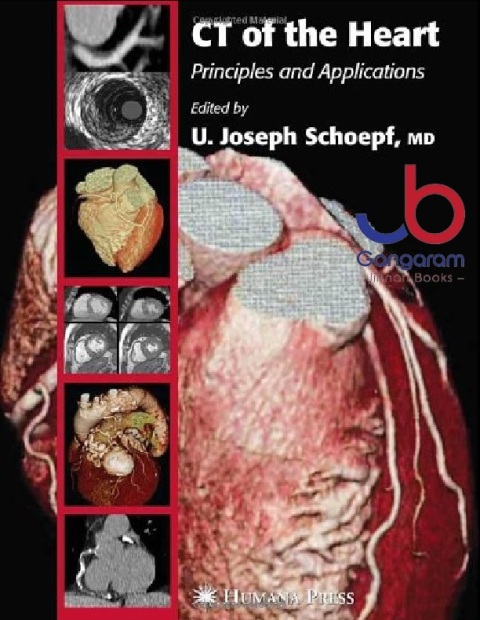 CT of the Heart Principles and Applications (Contemporary Cardiology) 1st Edition