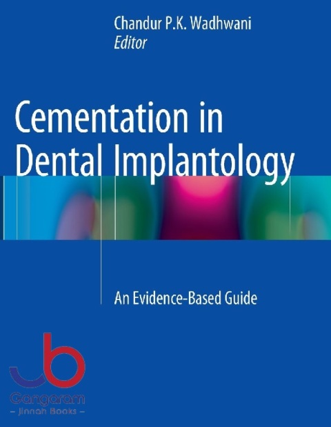 Cementation in Dental Implantology An Evidence-Based Guide