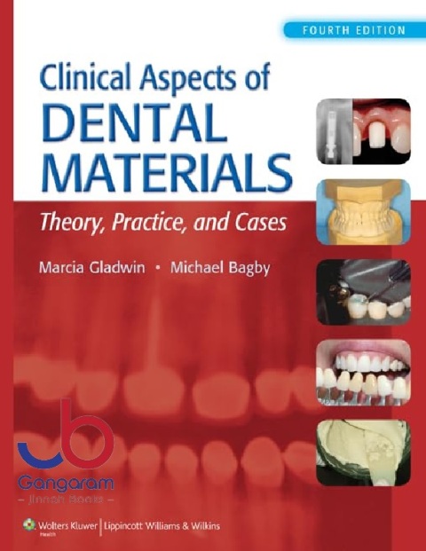 Clinical Aspects of Dental Materials Theory, Practice, and Cases